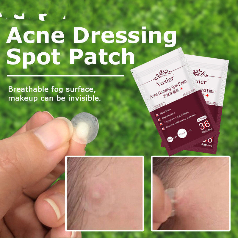 Invisible Acne Patch Set – Hydrocolloid Blemish Stickers for Pimple Treatment & Spot Protection