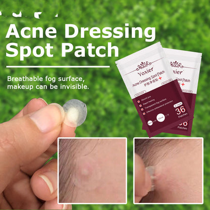 Invisible Acne Patch Set – Hydrocolloid Blemish Stickers for Pimple Treatment & Spot Protection