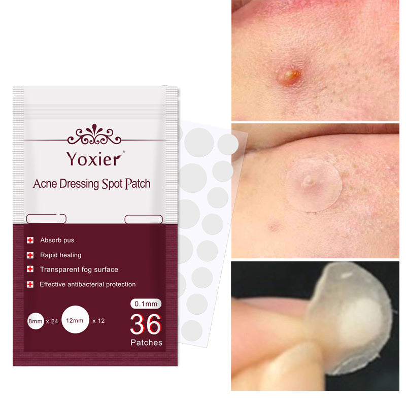 Invisible Acne Patch Set – Hydrocolloid Blemish Stickers for Pimple Treatment & Spot Protection
