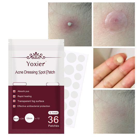 Invisible Acne Patch Set – Hydrocolloid Blemish Stickers for Pimple Treatment & Spot Protection