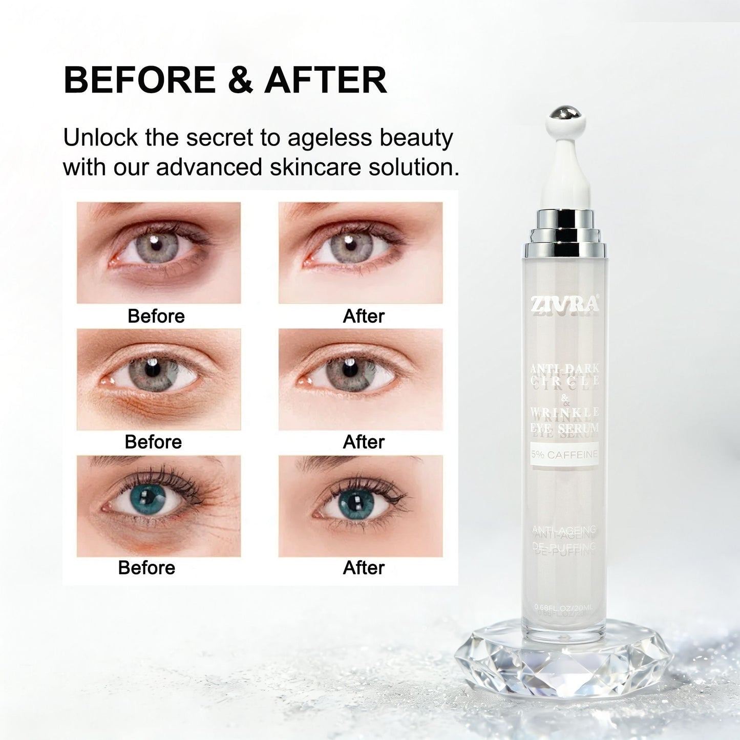 ZIVRA Anti Dark Circle Eye Serum with 5% Caffeine – De-Puffing & Anti-Ageing Under Eye Serum with 360° Roller Applicator 20ml